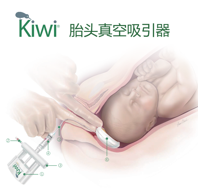廠商直銷進(jìn)口美國KIWI胎頭真空吸引器